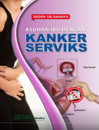 Asuhan ibu dengan Kanker serviks