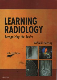 Learning Radiology Recognizing The Basics