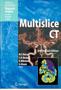 Multislice CT